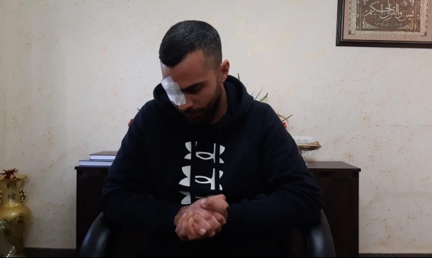 فقد عينه برصاصة شرطي..أحمد ذياب من طمرة يقدم شكوى "مدنية" ضد شرطة إسرائيل