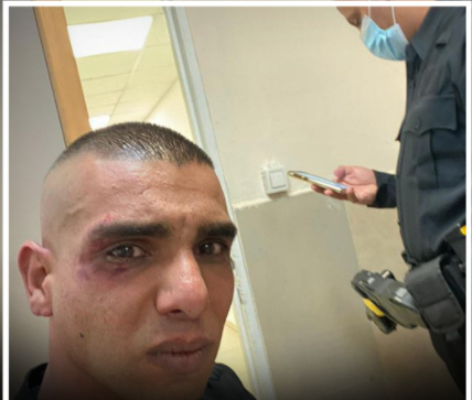 هاجموه بالمفكات والعصي والغاز.. 20 إسرائيليًا يُنكلون بشاب فلسطيني من جلجولية