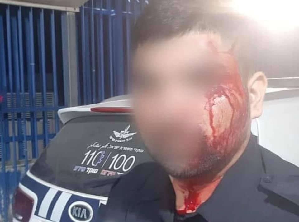 "نحن القانون هنا".. الشرطة الإسرائيلية تلملم جراحها بعد ضرب عناصرها بكفرقاسم