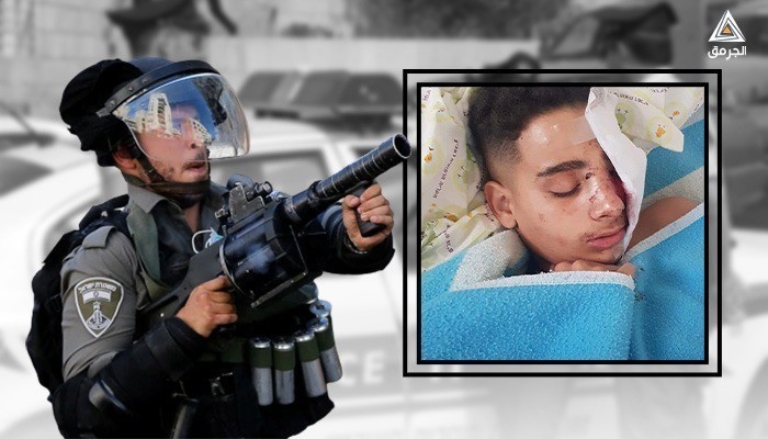 باسل أبو العلا.. طفلٌ فلسطيني قلعت الشرطة "الإسرائيلية" عينه