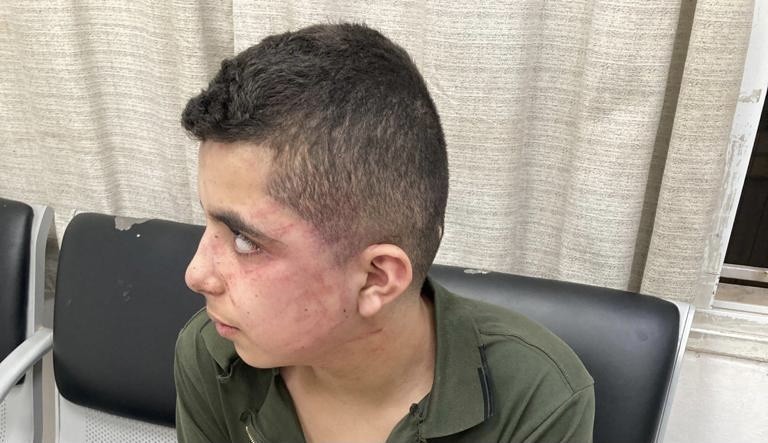 "شحار أسود" يتسبب في مأساة لطفل بالطيبة