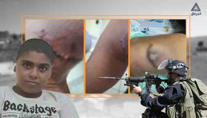 اليافاوي أحمد.. طفل غيّرت القوات "الإسرائيلية" مسار طريقه من البحر للمشفى