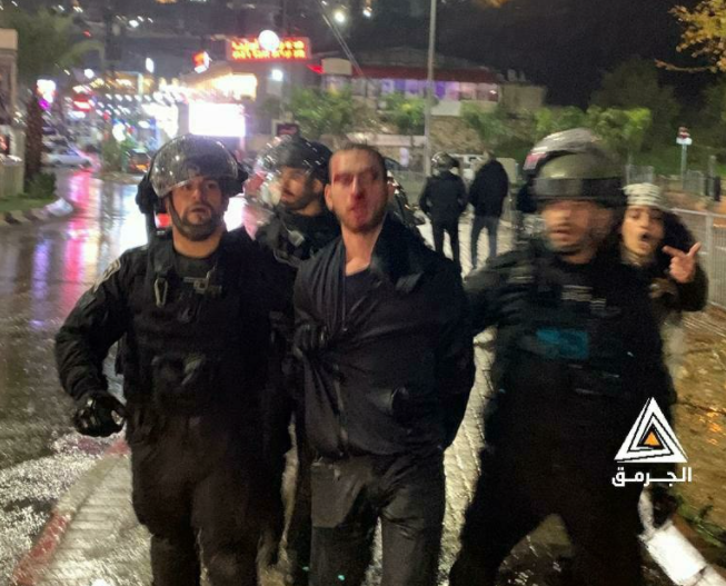 خرج نصرةً لأبو هواش..فضربوه واعتقلوه..الفحماوي حسن محاميد يروي للجرمق تفاصيل الاعتداء عليه من قبل الشرطة الإسرائيلية