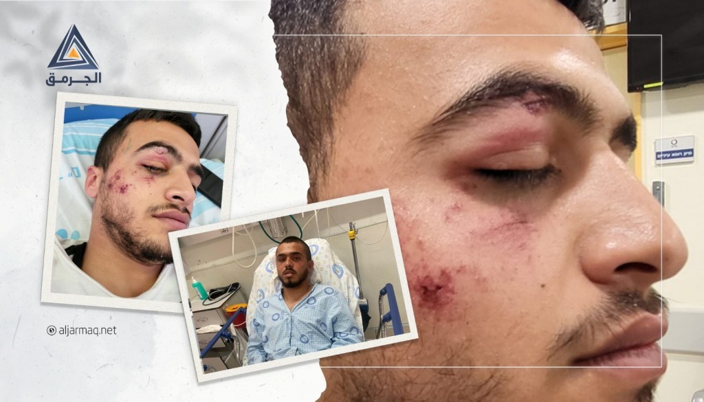 "كسروا جمجمة أحدهم..وضربوا الآخر حتى فقد الرؤية جزئيًا"..شرطة "إسرائيلي" تعتدي على قاصريَن من وادي عارة
