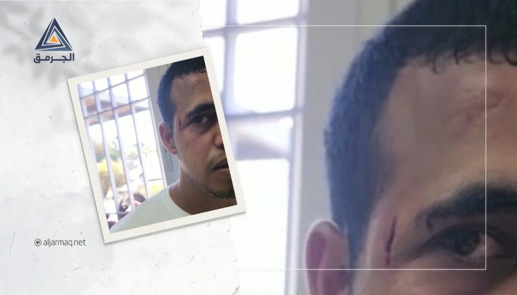 شرطة "إسرائيل" تعتدي بالضرب على عائلة في ترابين الصانع بينهم سيدات