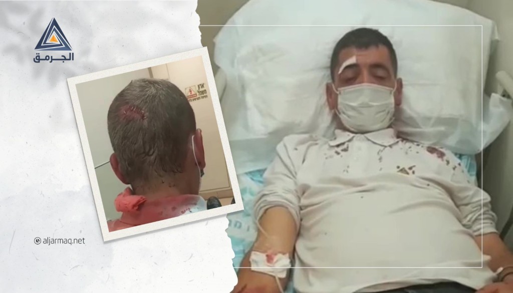 إسرائيليون يعتدون على نزيه بقاعي من كابول بالضرب المبرح ويتسببون له بجروح